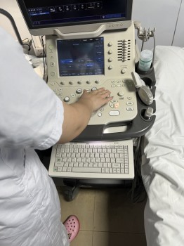 彩超东芝A300维修